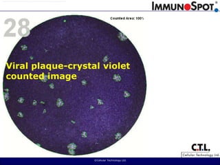  ©Cellular Technology Ltd. Viral plaque-crystal violetcounted image
