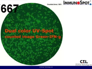  ©Cellular Technology Ltd. Dual color UV-Spotcounted image Green-IFN-g