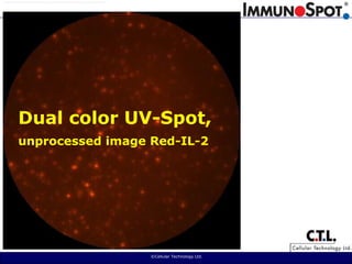  ©Cellular Technology Ltd. Dual color UV-Spot, unprocessed image Red-IL-2