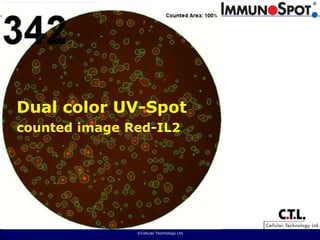  ©Cellular Technology Ltd. Dual color UV-Spotcounted image Red-IL2