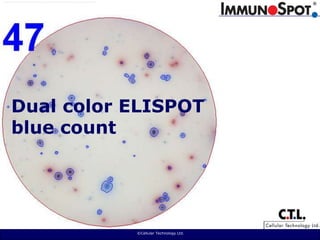  ©Cellular Technology Ltd. Dual color ELISPOTblue count 