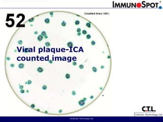  ©Cellular Technology Ltd. Viral plaque-ICAcounted image.