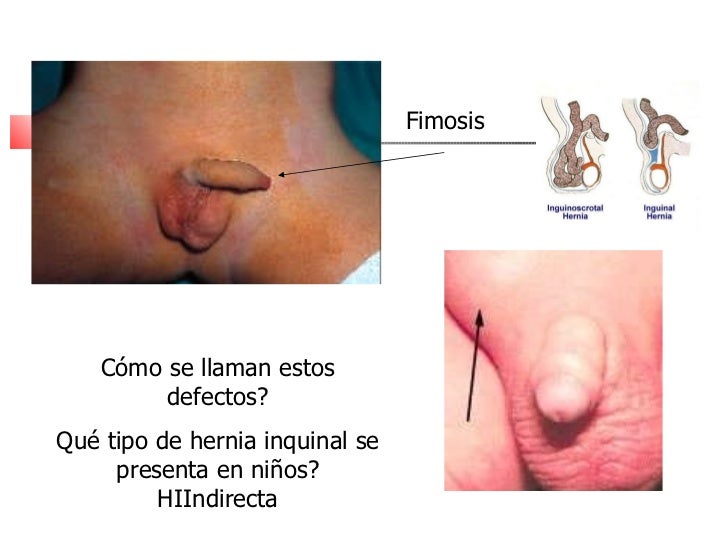 Como aumentar el pene de 14 años