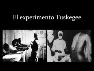 El experimento Tuskegee
 