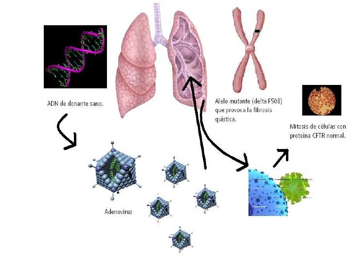 El Fin De La Fibrosis QuíStica El Fin De La Fibrosis QuíStica