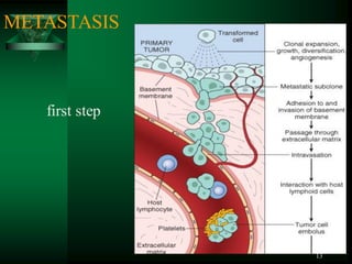 13
METASTASIS
first step
 