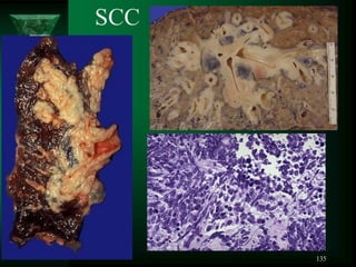 135
SCC
 