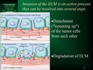 15
Detachment
("loosening up")
of the tumor cells
from each other
Degradation of ECM
Invasion of the ECM is an active process
that can be resolved into several steps
 