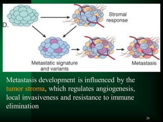 20
Metastasis development is influenced by the
tumor stroma, which regulates angiogenesis,
local invasiveness and resistance to immune
elimination
 