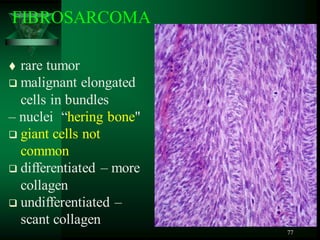 77
 rare tumor
 malignant elongated
cells in bundles
– nuclei “hering bone"
 giant cells not
common
 differentiated – more
collagen
 undifferentiated –
scant collagen
FIBROSARCOMA
 