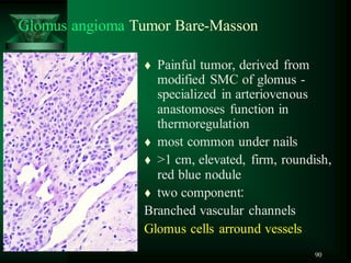 90
Glomus angioma Tumor Bare-Masson
 Painful tumor, derived from
modified SMC of glomus -
specialized in arteriovenous
anastomoses function in
thermoregulation
 most common under nails
 >1 cm, elevated, firm, roundish,
red blue nodule
 two component‫׃‬
Branched vascular channels
Glomus cells arround vessels
 