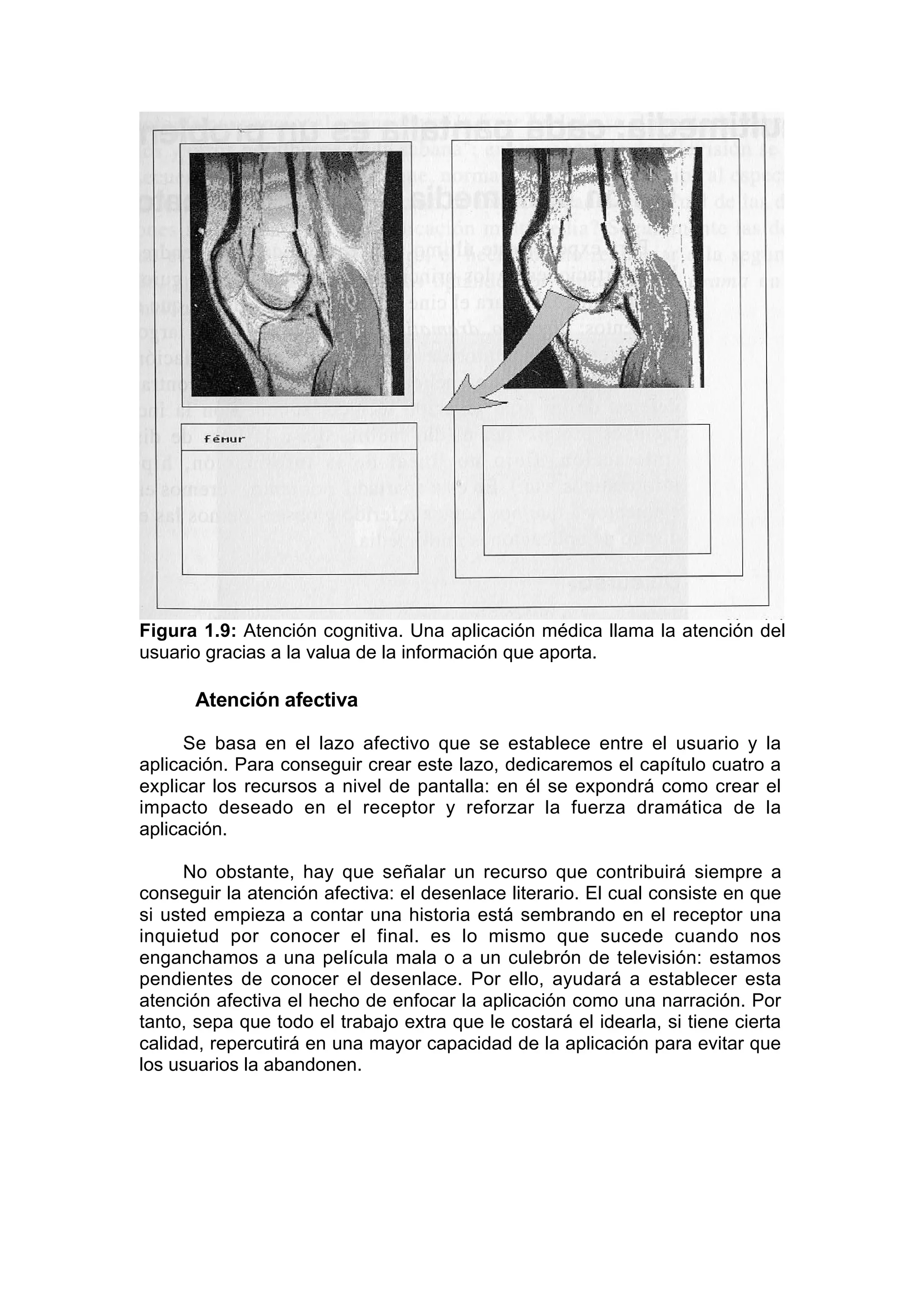 Figura 1.9: Atención cognitiva. Una aplicación médica llama la atención del
usuario gracias a la valua de la información que aporta.

      Atención afectiva

      Se basa en el lazo afectivo que se establece entre el usuario y la
aplicación. Para conseguir crear este lazo, dedicaremos el capítulo cuatro a
explicar los recursos a nivel de pantalla: en él se expondrá como crear el
impacto deseado en el receptor y reforzar la fuerza dramática de la
aplicación.

     No obstante, hay que señalar un recurso que contribuirá siempre a
conseguir la atención afectiva: el desenlace literario. El cual consiste en que
si usted empieza a contar una historia está sembrando en el receptor una
inquietud por conocer el final. es lo mismo que sucede cuando nos
enganchamos a una película mala o a un culebrón de televisión: estamos
pendientes de conocer el desenlace. Por ello, ayudará a establecer esta
atención afectiva el hecho de enfocar la aplicación como una narración. Por
tanto, sepa que todo el trabajo extra que le costará el idearla, si tiene cierta
calidad, repercutirá en una mayor capacidad de la aplicación para evitar que
los usuarios la abandonen.
 