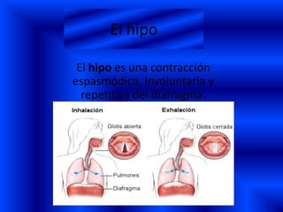 El hipo

 El hipo es una contracción
espasmódica, involuntaria y
  repetitiva del diafragma.
 