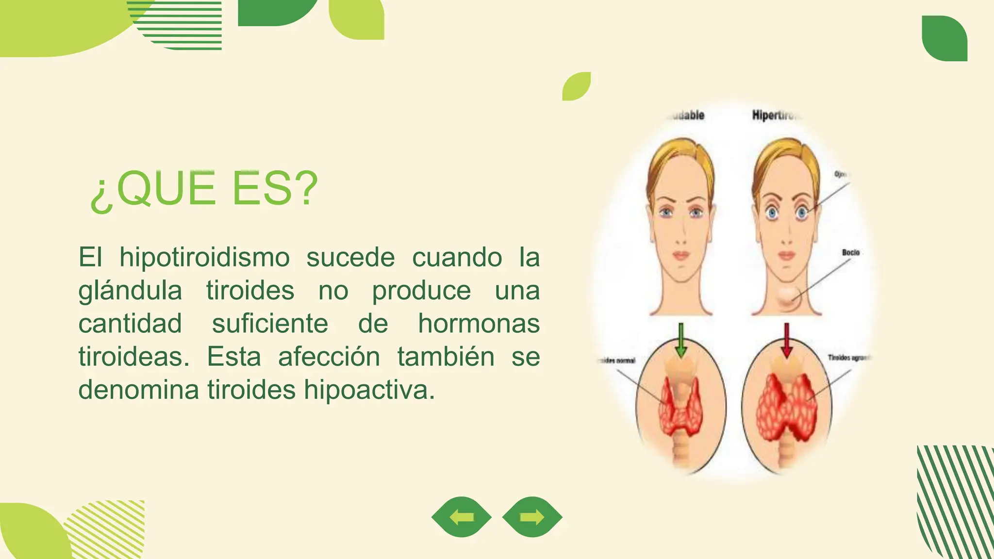 el-hipotiroidismo-o-tiroides-hipoactiva-pptx