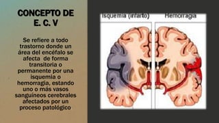 CONCEPTO DE
E. C. V
Se refiere a todo
trastorno donde un
área del encéfalo se
afecta de forma
transitoria o
permanente por una
isquemia o
hemorragia, estando
uno o más vasos
sanguíneos cerebrales
afectados por un
proceso patológico.
 