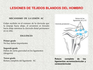 LESIONES DE TEJIDOS BLANDOS DEL HOMBRO


      MECANISMO DE LA LESIÓN AC

Golpe recibido en el extremo de la clavícula que
la empuja hacia abajo, el acromion es forzado
hacia abajo mientras la clavícula distal permanece
en su sitio.

                  ESGUINCES

Primer grado
No hay daños importantes

Segundo grado
Daños de cierta gravedad en los ligamentos
(desgarro)

Tercer grado                                         Rotura   completa    de    los
Rotura completa del ligamento AC                     ligamentos acromioclavicular y
                                                     coracoclavicular
 