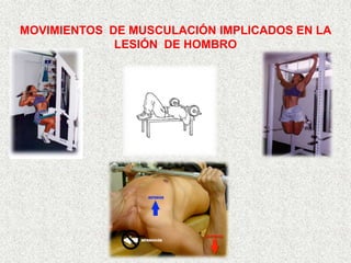 MOVIMIENTOS DE MUSCULACIÓN IMPLICADOS EN LA
             LESIÓN DE HOMBRO
 
