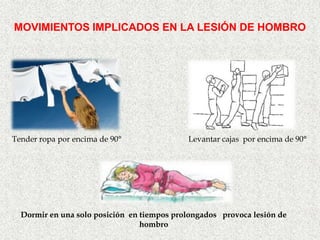 MOVIMIENTOS IMPLICADOS EN LA LESIÓN DE HOMBRO




Tender ropa por encima de 90°               Levantar cajas por encima de 90°




  Dormir en una solo posición en tiempos prolongados provoca lesión de
                                 hombro
 