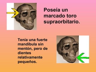 Tenía una fuerte mandíbula sin mentón, pero de dientes relativamente pequeños. Poseía un marcado toro supraorbitario.