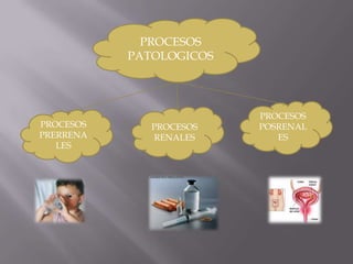 PROCESOS PATOLOGICOSPROCESOS POSRENALESPROCESOS RENALESPROCESOS PRERRENALES