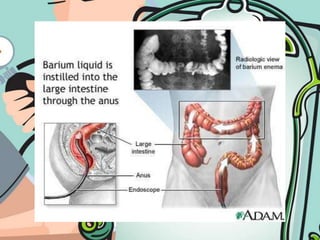 Assessment of the GITMTCAT '091. Inspectionassess the skin for color, texture, scars, striae, engorged veins, visible peristalsis (intestinal obstruction), visible pulsations (abdominal aorta), visible masses (hernia)