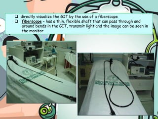 Normoactive – every 5-20 secs.