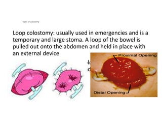 Elimination Patterns: Understanding Human Excretory Functions