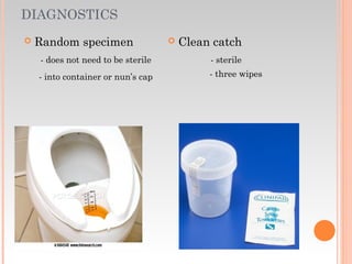 DIAGNOSTICS
 Random specimen
- does not need to be sterile
- into container or nun’s cap
 Clean catch
- sterile
- three wipes
 