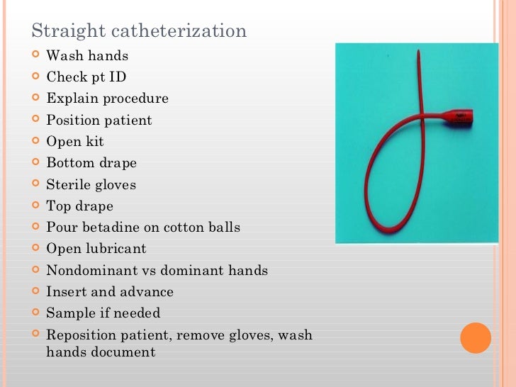 Elimination summer 2012