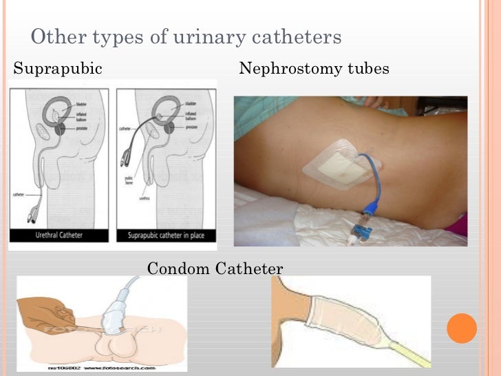 Elimination summer 2012