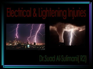 Electrical & Lightening Injuries Dr.Suad Al-Sulimani( R2) 