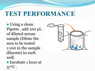 TEST PERFORMANCE
 Using  a clean
Pipette , add 100 µL
of diluted serum
sample (Dilute the
sera to be tested
1:100 in the sample
diluents) to each
well.
 Incubate 1 hour at
37°C .
 