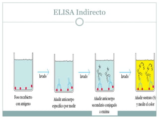 ELISA Indirecto

 