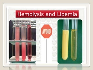 Hemolysis and Lipemia

 