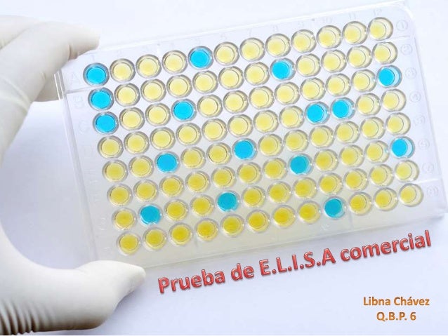 prueba elisa 1 638