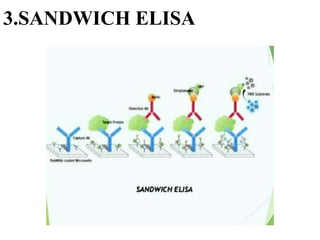 3.SANDWICH ELISA
 