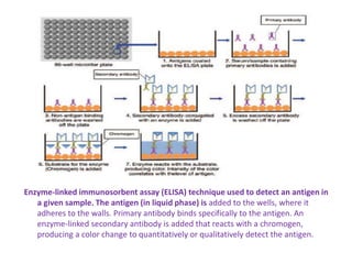 Enzyme-linked immunosorbent assay (ELISA) technique used to detect an antigen in
a given sample. The antigen (in liquid phase) is added to the wells, where it
adheres to the walls. Primary antibody binds specifically to the antigen. An
enzyme-linked secondary antibody is added that reacts with a chromogen,
producing a color change to quantitatively or qualitatively detect the antigen.
 