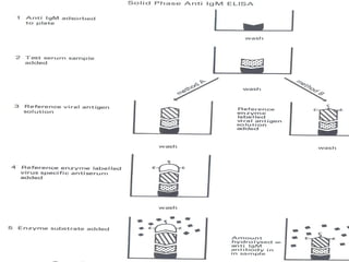 Enzyme Linked Immunosorbent Assay (ELISA) | PPT