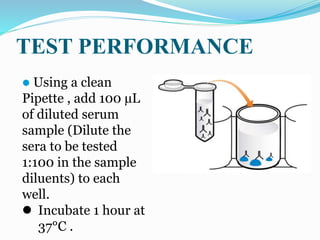  Using a clean
Pipette , add 100 µL
of diluted serum
sample (Dilute the
sera to be tested
1:100 in the sample
diluents) to each
well.
 Incubate 1 hour at
37°C .
TEST PERFORMANCE
 
