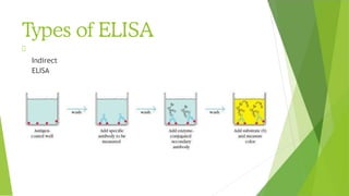 Types of ELISA
Indirect
ELISA
 