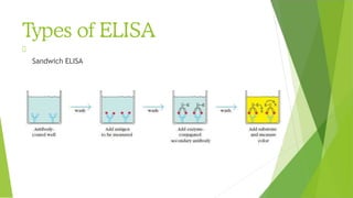 Types of ELISA
Sandwich ELISA
 