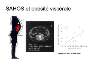 Vgontzas AN, JCEM 2000. SAHOS et obésité viscérale 