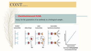 – Chemiluminescent ELISA.
Assay for the quantation of an antibody in a biological sample .
 