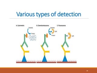 Various types of detection
68
 