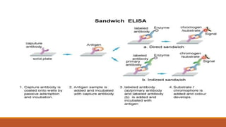 Enzyme linked immunosorbent assay .pptx