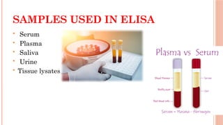 SAMPLES USED IN ELISA
 Serum
 Plasma
 Saliva
 Urine
 Tissue lysates
 