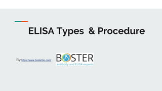 ELISA Types & Procedure
By:https://www.bosterbio.com/
 