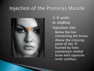 botox training | PDF