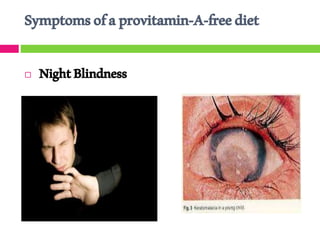 Symptomsofaprovitamin-A-freediet
 NightBlindness
 