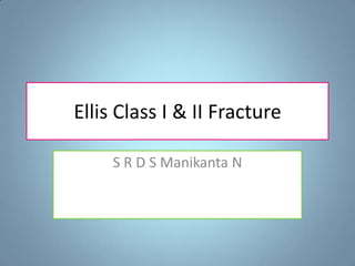 Ellis Class I & II Fracture
S R D S Manikanta N

 